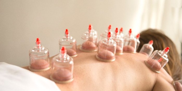 Ventosaterapia o cupping en Cuenca